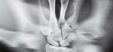 sana_skeletal_trauma